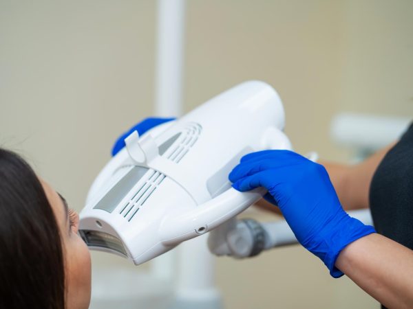 teeth whitening in lymington
