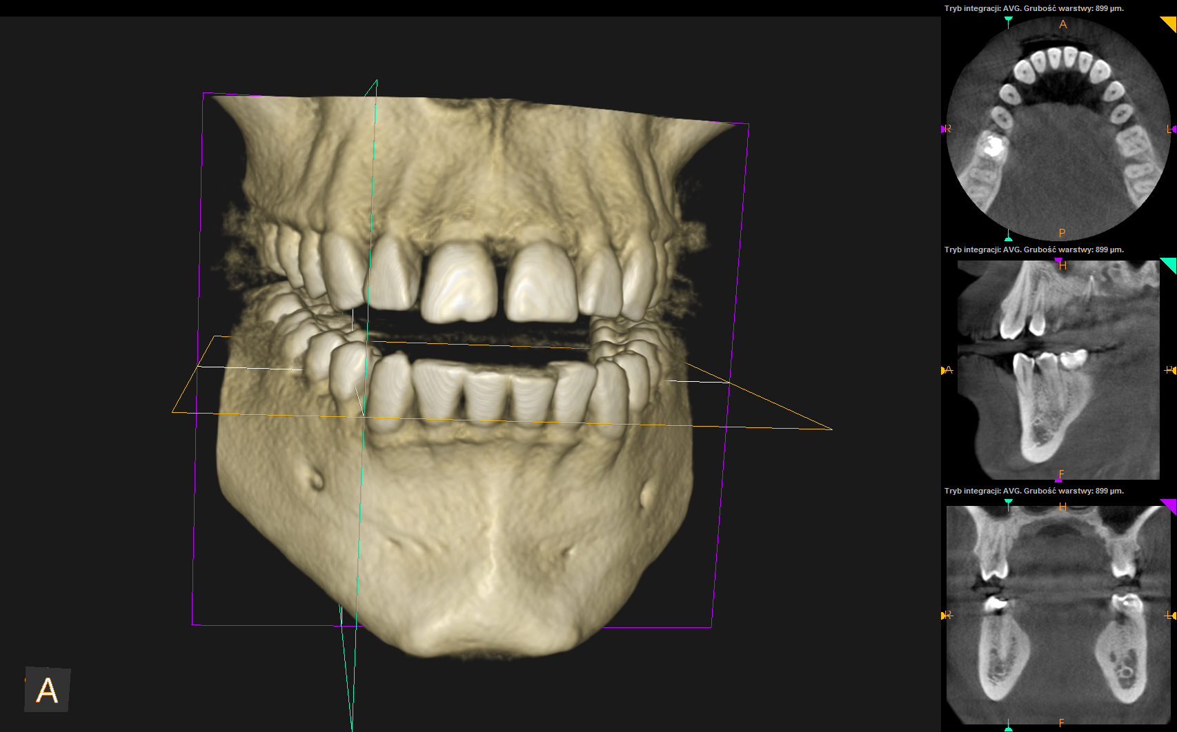 Agata- cbct scan