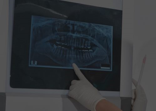 X-Ray-1-1024×357 (2)