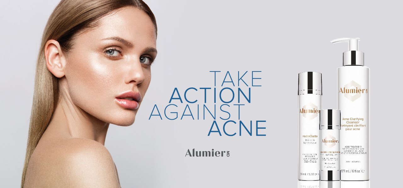 Take Action Against Acne Web Banner chemical peel for acne new forest