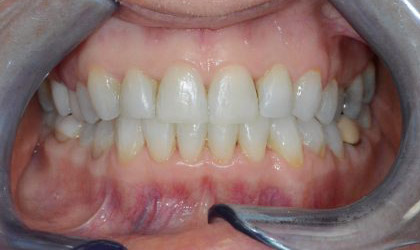 invisalign doctor hythe