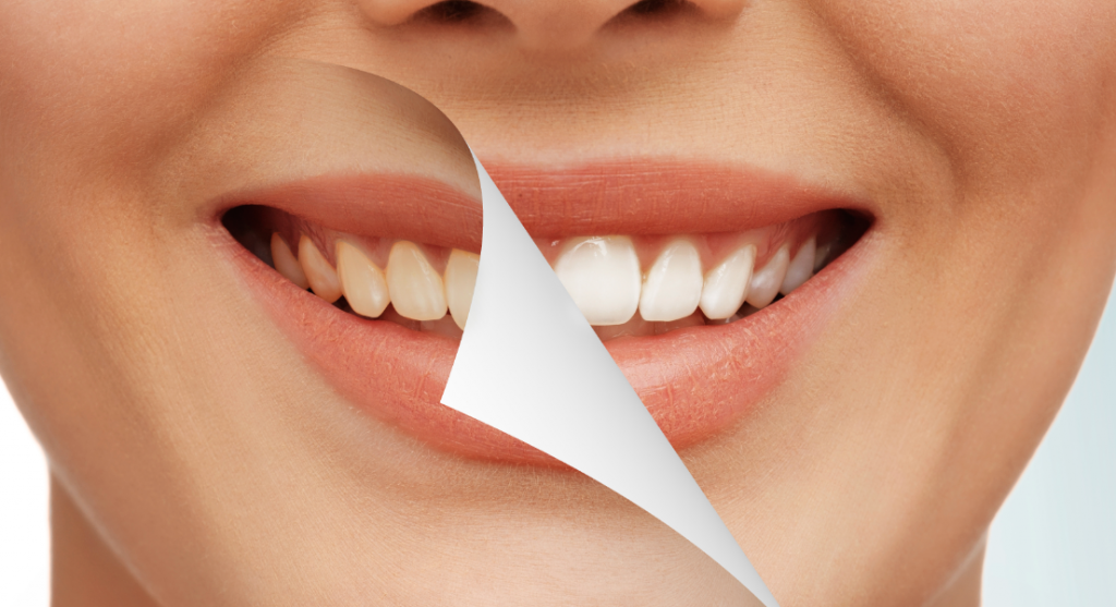 Zoom cosmetic dentistry cost lyndhurst